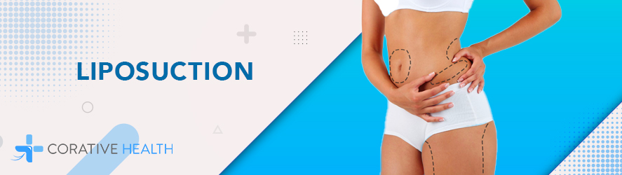 Liposuction in der Türkei