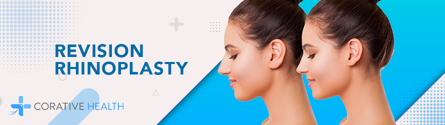 Revision Rhinoplasty